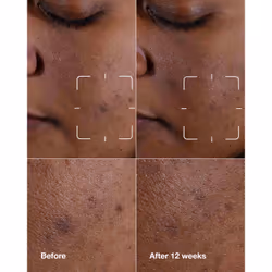 Clinique Even Better Clinical Dark Spot Clearing Serum Siero per viso 30 ml Donna - Vista aggiuntiva 2