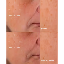 Clinique Even Better Clinical Dark Spot Clearing Serum Siero per viso 30 ml Donna - Vista aggiuntiva 3