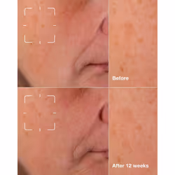 Clinique Even Better Clinical Dark Spot Clearing Serum 50 ml Donna - Vista aggiuntiva 3