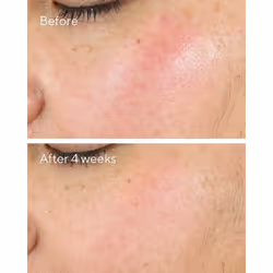 Murad 15293 crema viso giorno e notte Crema giorno e notte All ages 50 ml - Vista aggiuntiva 4