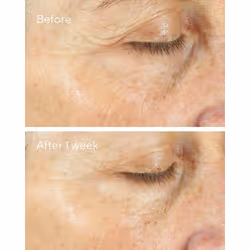 Murad 15293 crema viso giorno e notte Crema giorno e notte All ages 50 ml - Vista aggiuntiva 5