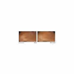 ROC Retinol Correxion Wrinkle Correct Daily Moisturiser SPF 30 per Idratazione e Protezione Solare 30 ml