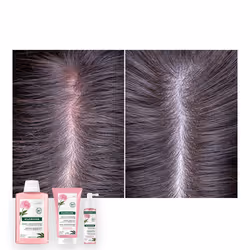 Klorane Shampoo Lenitivo Bio alla Peonia 400ml - Vista aggiuntiva 4