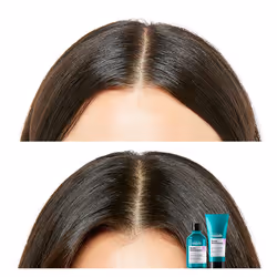 Scalp Advanced shampoo cuoio capelluto sensibile 300 ml