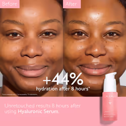 Caudalie VinoHydra Siero Ialuronico Idratante 30 ml - Vista aggiuntiva 4
