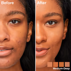 Instant Perfector Glow Multiuso #03-medio-profondo - Vista aggiuntiva 4