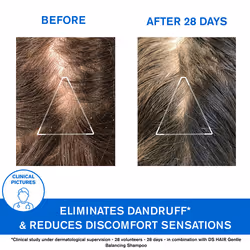 Uriage Ds Hair Shampoo Antiforfora 200ml - Vista aggiuntiva 4