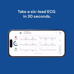Omron Kardia Mobile 6L Elettrocardiogramma Portatile ECG Casalingo 6 Derivazioni 1 Pezzo - Vista aggiuntiva 8