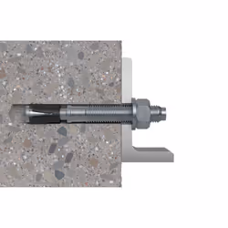 Fischer 501413 ancoraggio a vite e tassello 20 pz Tassello di espansione 110 mm