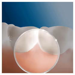 Oral-B Oxyjet Sistema Pulente Con Idropulsore Con 4 Testine Oxyjet - Vista aggiuntiva 5