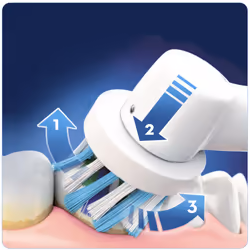 Oral-B SmartSeries 4000 Spazzolino Elettrico - Vista aggiuntiva 5
