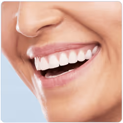 Oral-B Pro 750 Sensi Ultrathin Adulto Spazzolino rotante-oscillante Blu - Vista aggiuntiva 7