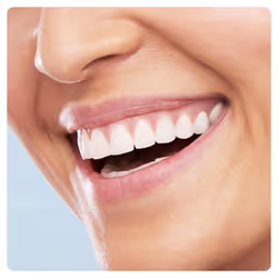 Oral-B Pulsonic Slim Luxe 4100 Adulto Spazzolino elettrico sonico Rose Gold - Vista aggiuntiva 4