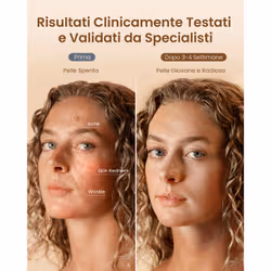 Renpho Artemis Blush E100B-1, Maschera Viso LED in Silicone Morbido, 4 Modalità di Luce, 432 LED e Copertura Mento - Vista aggiuntiva 3