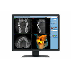 EIZO RadiForce MX217-SB 21" UXGA LCD Nero