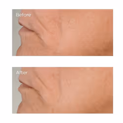 Perricone MD High Potency Growth Factor Firm & Lifting Siero per viso 59 ml Donna Freschezza - Vista aggiuntiva 6