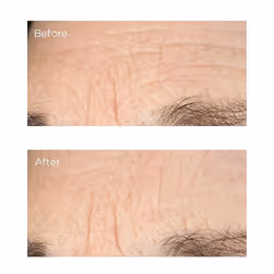 Perricone MD Essential Fx Acyl-Glutathione: Deep Crease Siero per viso 30ml Donna Rosa - Vista aggiuntiva 4