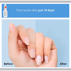 Eveline Cosmetics Siero Professionale per la ricostruzione delle unghie 8in1 Azione Totale 12 ml - Vista aggiuntiva 4