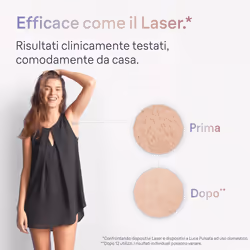 Braun Epilatore Luce Pulsata Smart Skin I·Expert, Epilazione A Casa Tua, Custodia, Rasoio Donna Venus, 2 Testine, PL7147 - Vista aggiuntiva 4