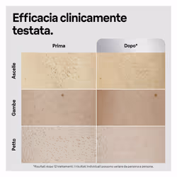 Braun Silk-expert Pro Epilatore Luce Pulsata Silk·expert Pro 5, Epilazione A Casa Tua, Con Custodia, Rasoio Uomo Gillette, 2 Testine, PL5145 - Vista aggiuntiva 6