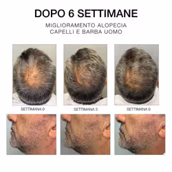 Diego dalla Palma SIERO 6 - Trattamento rinforzante per crescita capelli e per cuoio capelluto 50ml - Vista aggiuntiva 4