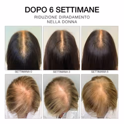 Diego dalla Palma SIERO 6 - Trattamento rinforzante per crescita capelli e per cuoio capelluto 50ml - Vista aggiuntiva 7