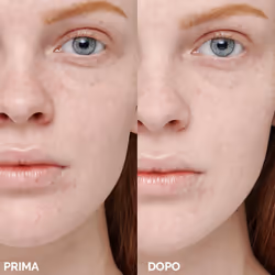 Veralab Suprimer Perfezionatore cutaneo e pore minimizer 25 ml - Vista aggiuntiva 5