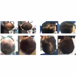 Tricomix Fibre di Cheratina Blond 12g - Vista aggiuntiva 7