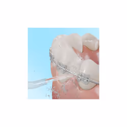 Cecotec 04315 idropulsore 1 L - Vista aggiuntiva 8