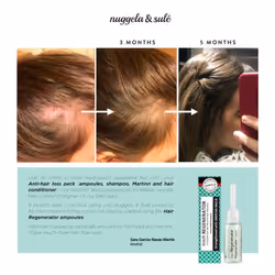 Nuggela & Sulé 1401-61559 soluzione contro al perdita di capelli 10 ml Unisex