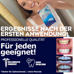 Lovely Smile WHITE-STRIPS Strisce sbiancanti per i denti 1 St