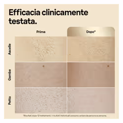 Braun Silk-expert Pro Epilatore Luce Pulsata Silk·expert Pro 5, Epilazione A Casa Tua, Con Custodia, Rasoio Donna Venus, 4 Testine, PL5356 - Vista aggiuntiva 7