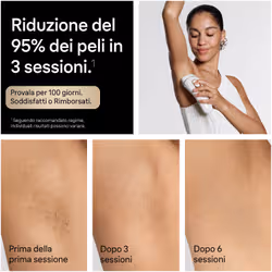 Braun Silk-Expert Pro 5 Silk·expert Pro 5, Epilatore A Luce Pulsata, 2 Testine, Custodia E Rasoio Gillette Venus, PL5234 - Vista aggiuntiva 5