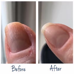 Herome Exit Damaged Nails Rinforzante per unghie 7 ml - Vista aggiuntiva 3